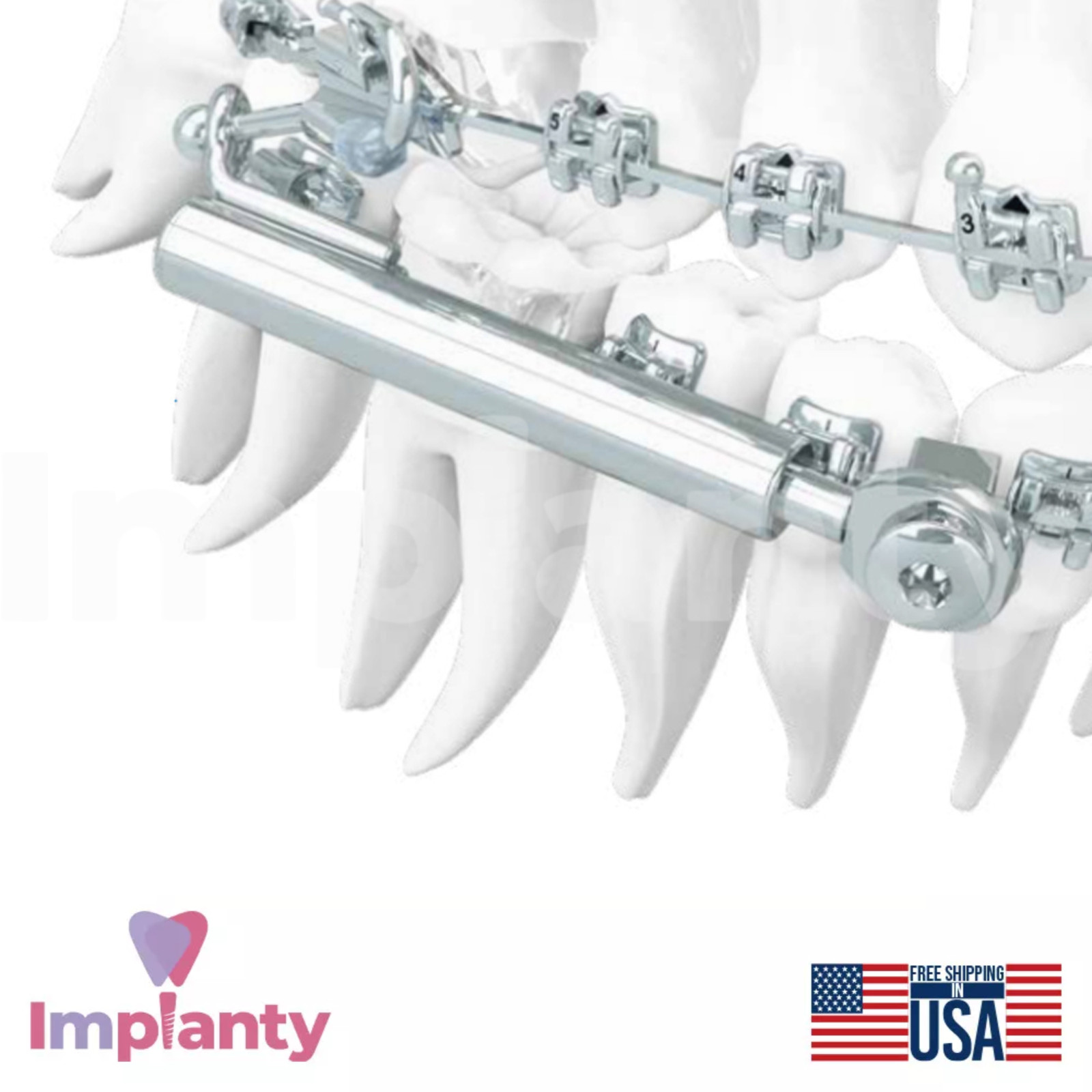 Dental SUS³ Sabbagh Universal Spring Application Set Stainless Steel 27mm
