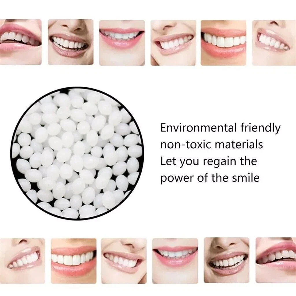 Dental Moldable Thermal Temporary Filling Tooth Material False Repair Replacemen