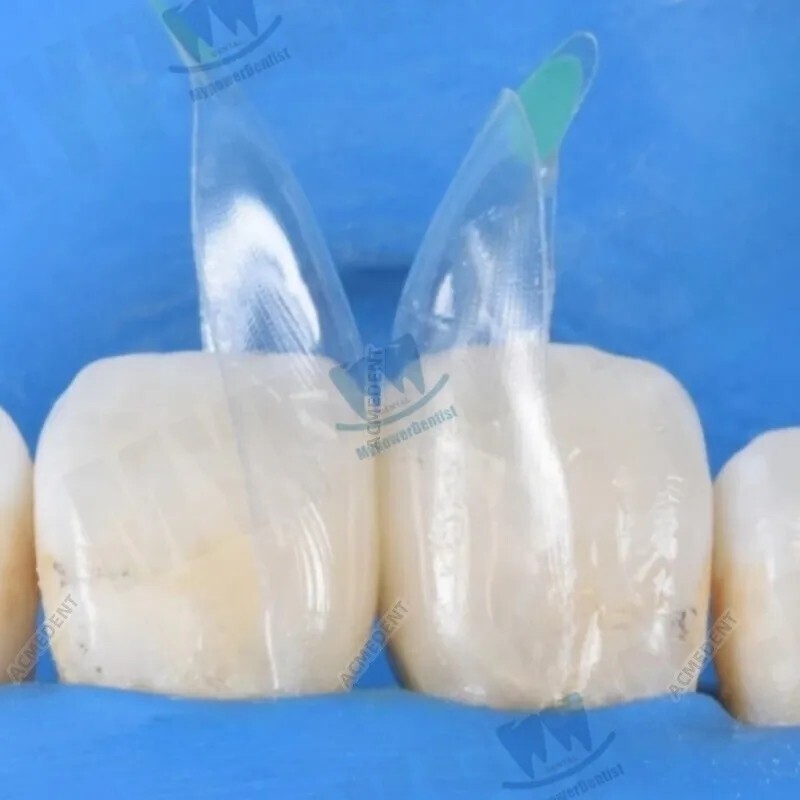 Dental Clear Matrix Diastema Matrices Wedges Similar with BioClear Matrice