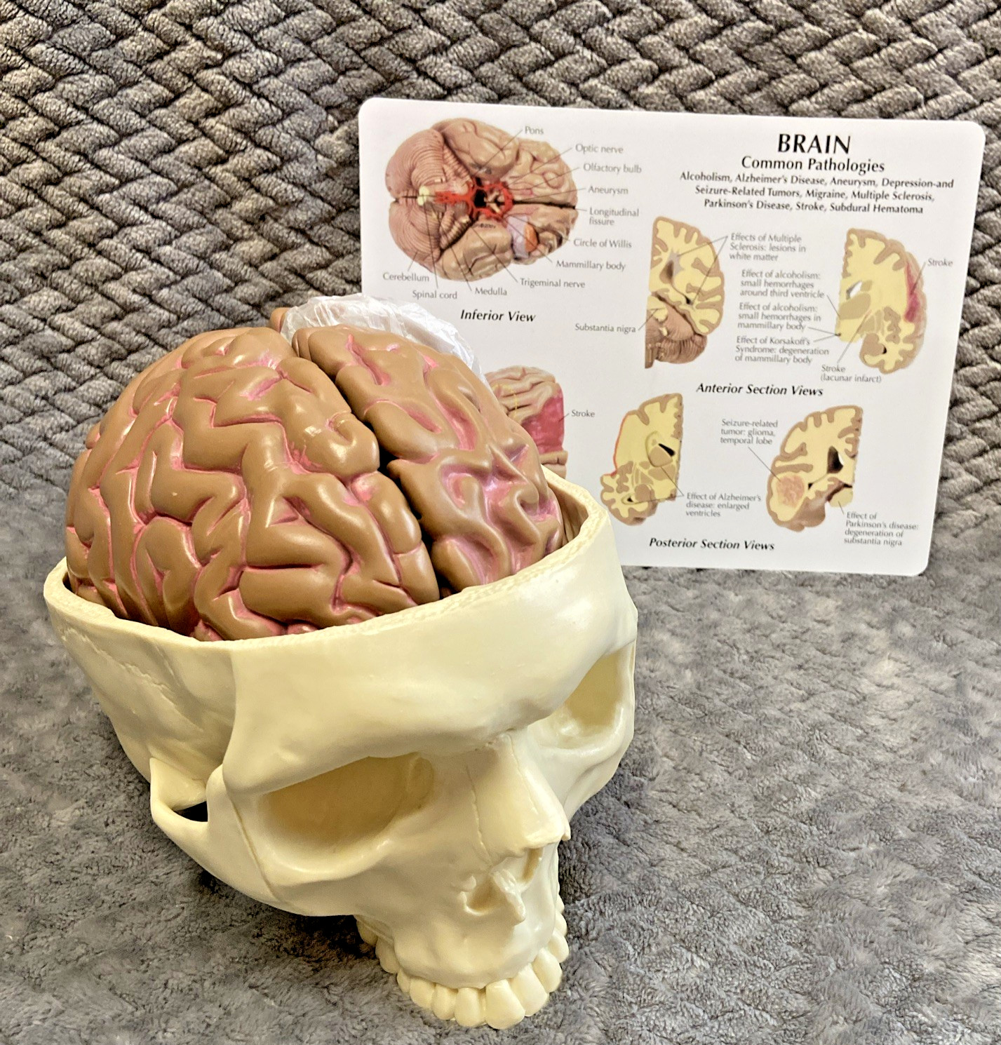 GPI 2900 Brain Model & Partial Skull Anatomical Model Home School Professional