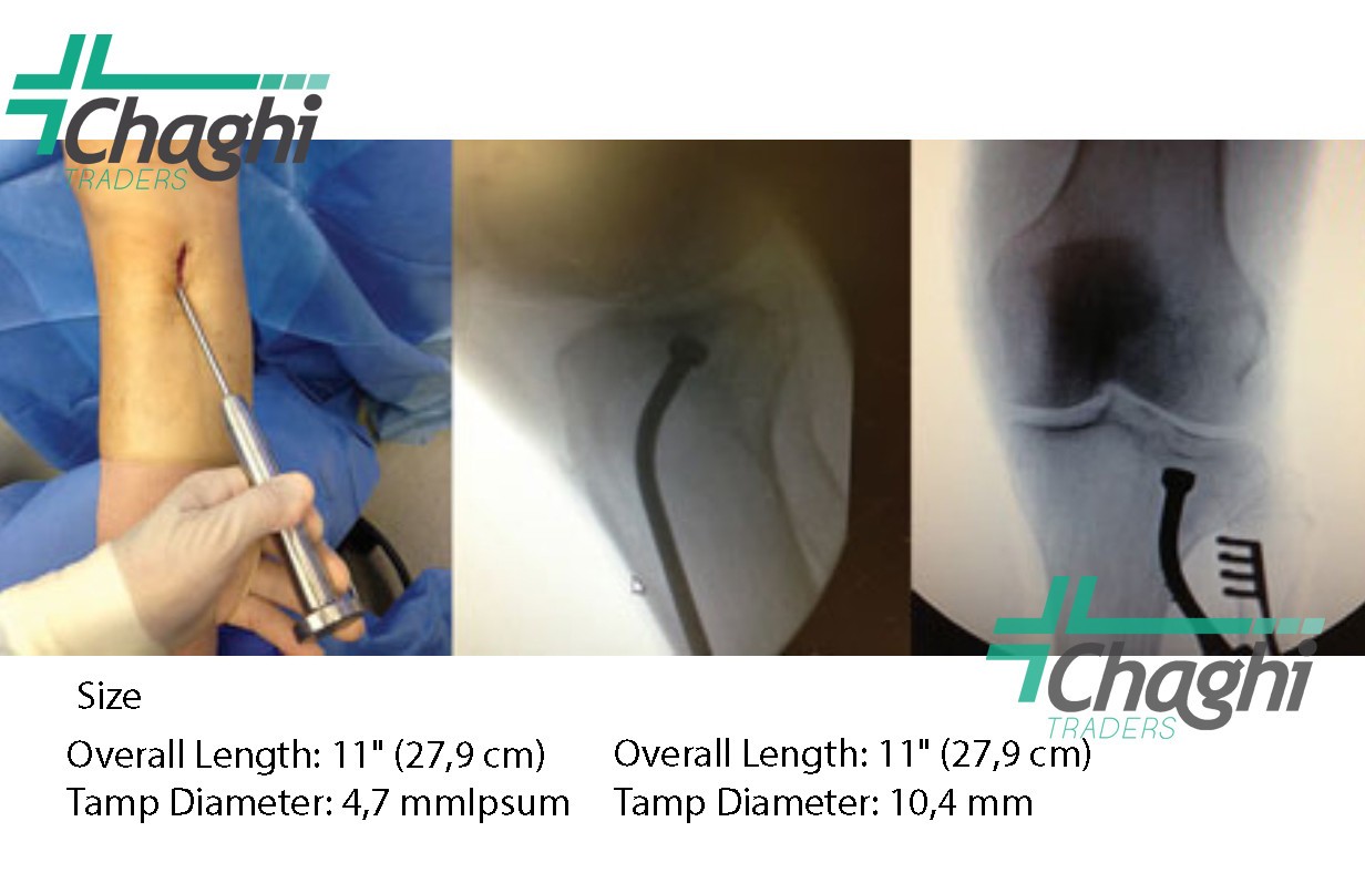 Bacastow Tibial Plateau Elevators Set of 2 Knee Tibia Arthroplasty Orthopedic CT