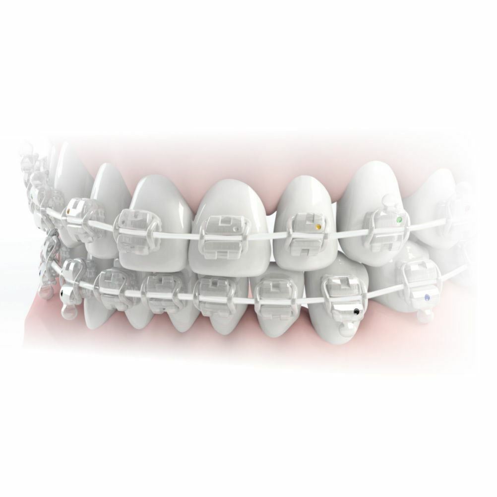 NiTi Dental White Orthodontic Archwire Superelastic Aesthetic Round 5 Wires