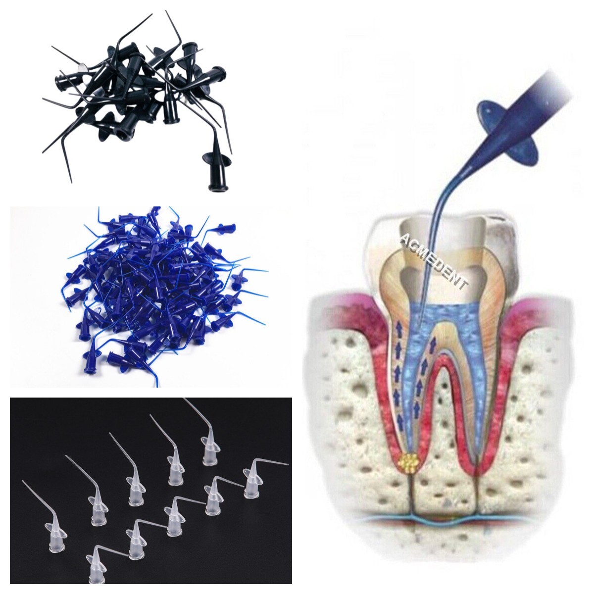 Dental Disposable Irrigation Tip Endo Root Canal Irrigator Tip Plastic Blue