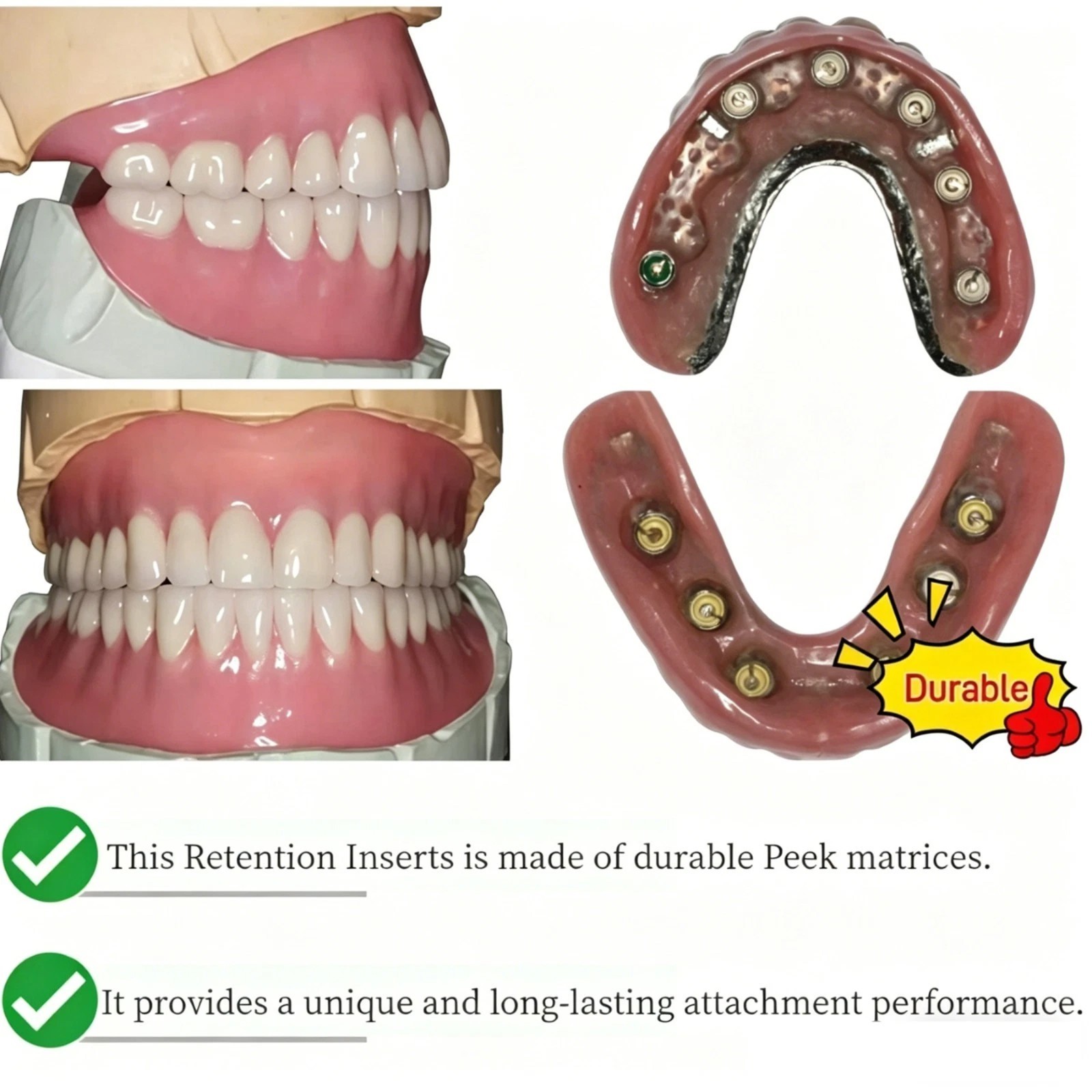 US Dental Novaloc Retention Insert PEEK Caps Titanium Matrix Housing & Core Tool