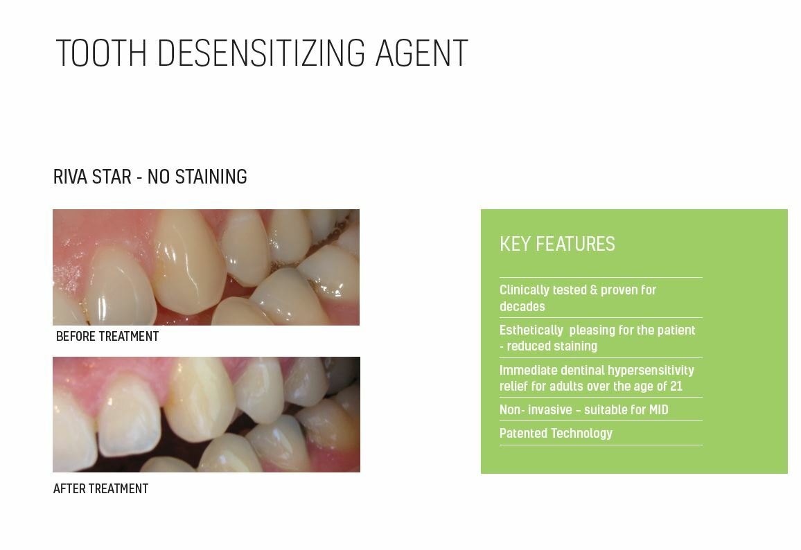 SDI Riva Star Tooth Desensitizer Bottle Kit (Total 4.5mL) EXP: 2025-03-30