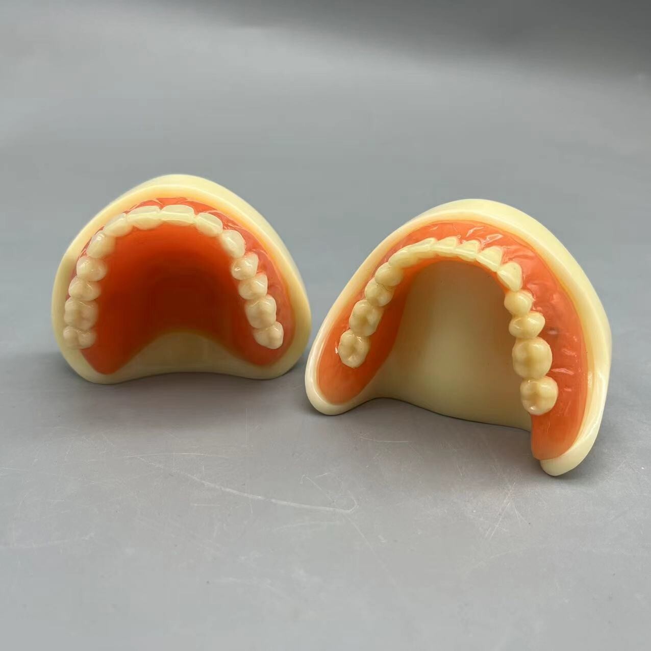 Dental 2 Implants Overdenture Typodont Restoration Upper Lower Lower Teeth Model