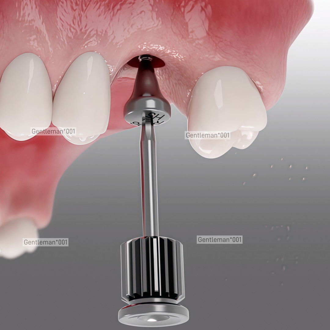 Dental Implan Healing Abutment Caps Cover Screw Mini Regular Platform Titanium