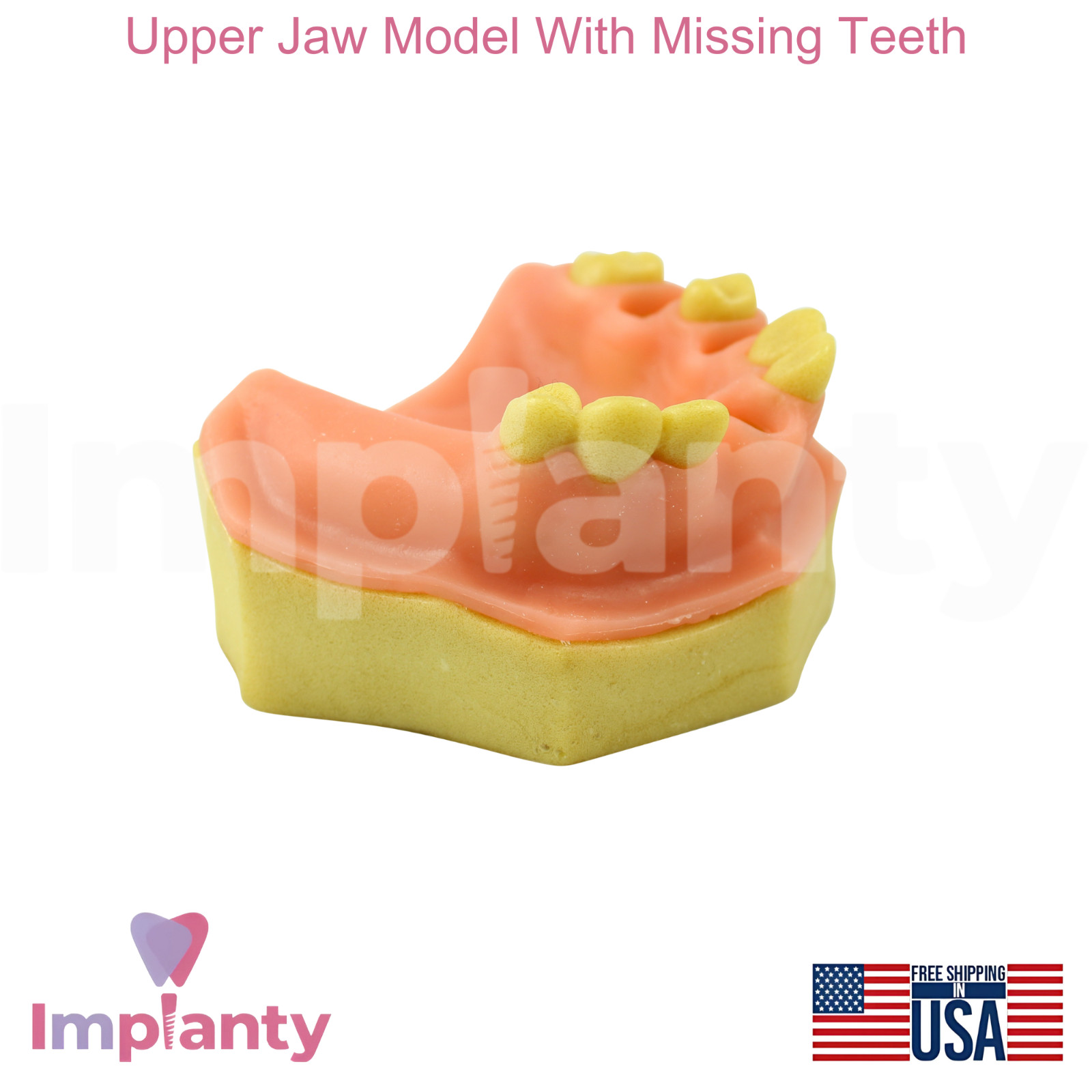 Upper Jaw Model With Missing Teeth Dental Teaching and Dentistry Practice Aid