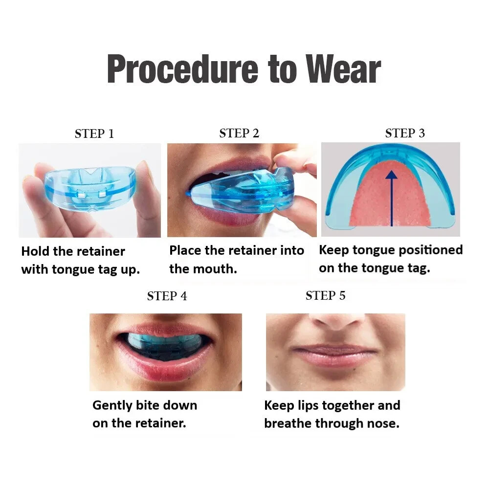 U Ortho Retainers Free Shipping Worldwide