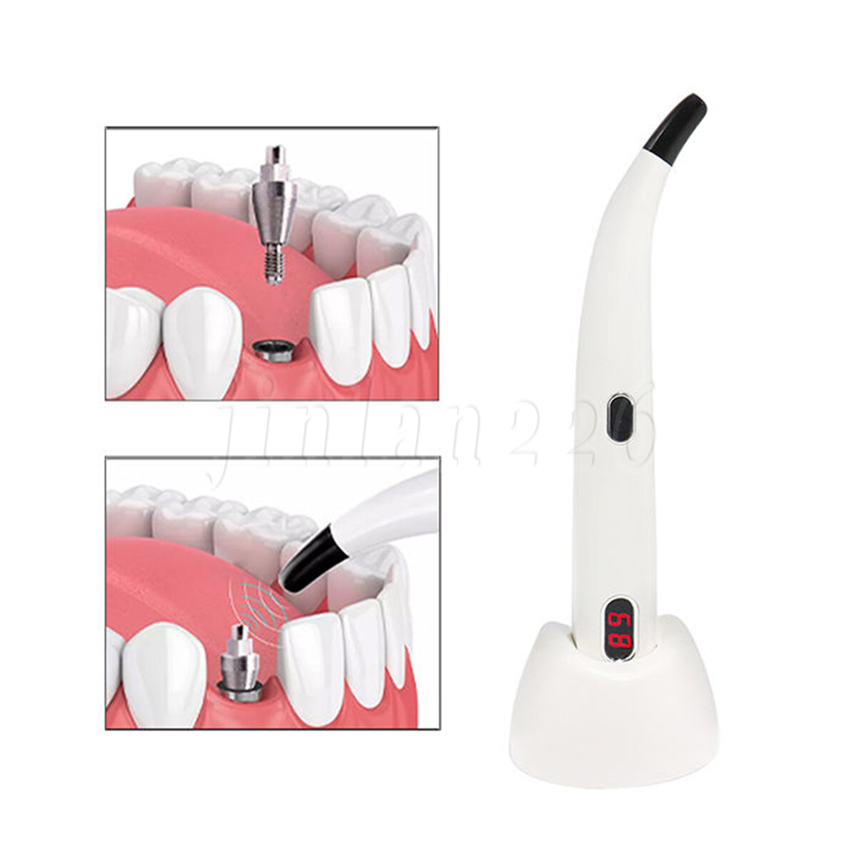 2024 Dental ISQ Implant Stability Device Dental Implant Monitor Osseointegration