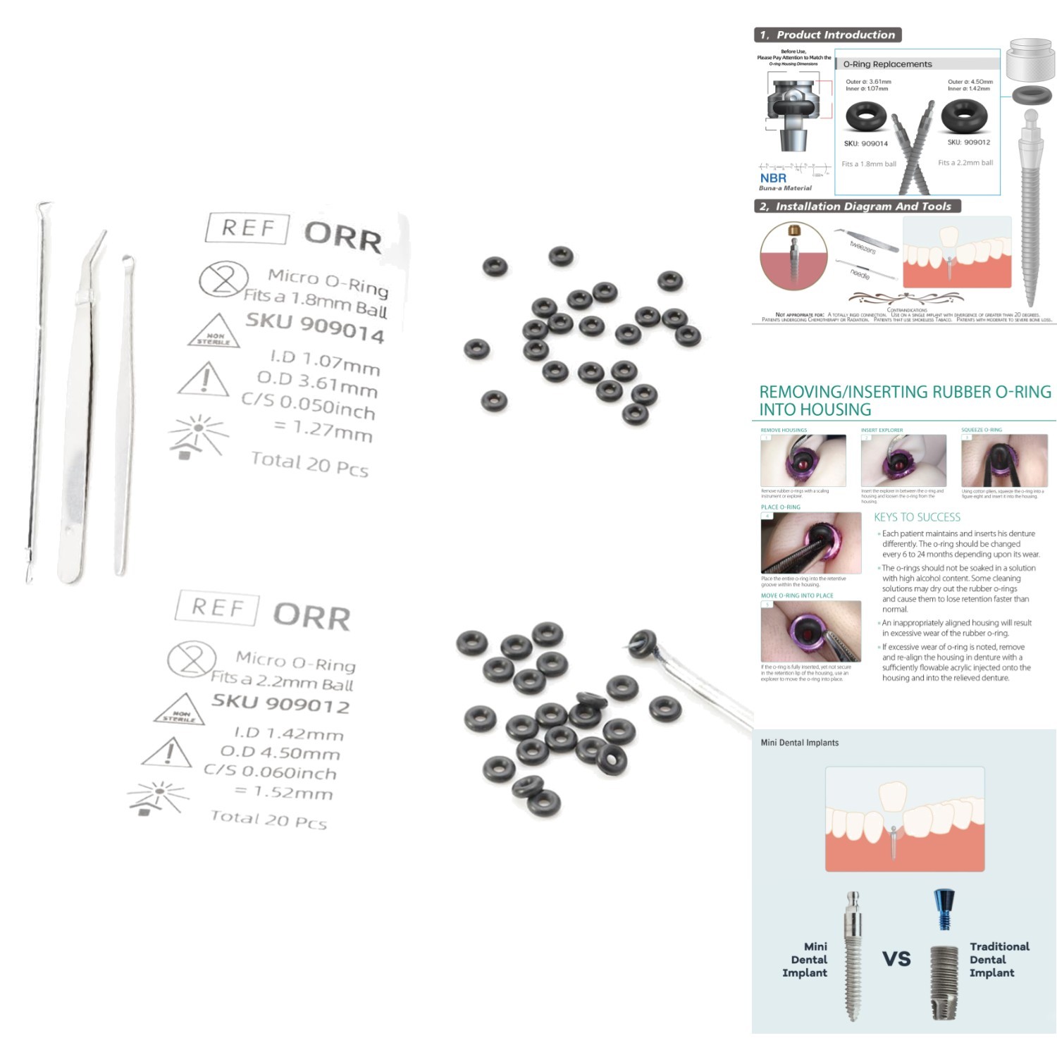 40pc Micro O-Ring Kit Mini Dental Implants Fits 1.8mm & 2.2mm Ball Attachments