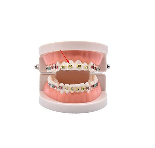 O & S Dental Topsticks High Performance Ortho Elastic Ligature Ties All Colors