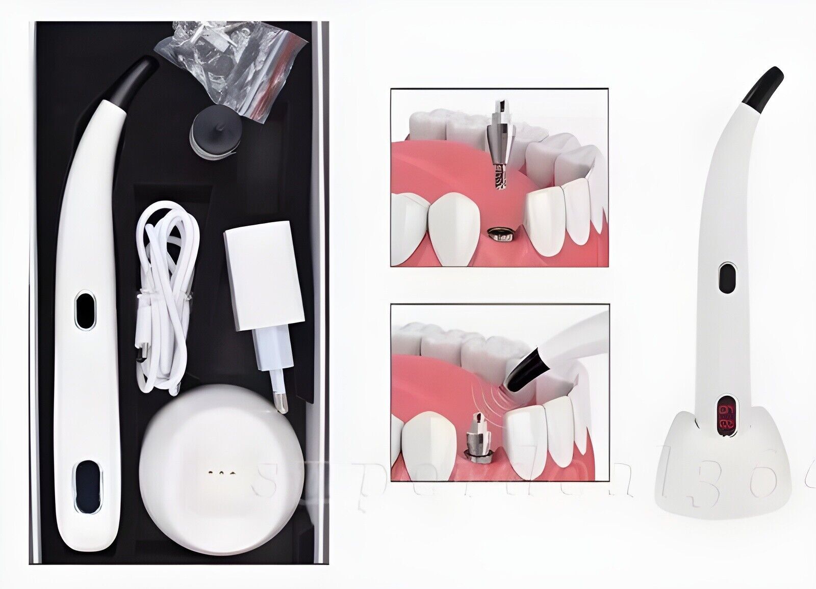 2026 Dental Implant Osseointegration Monitor Stability Measurement Tester USA