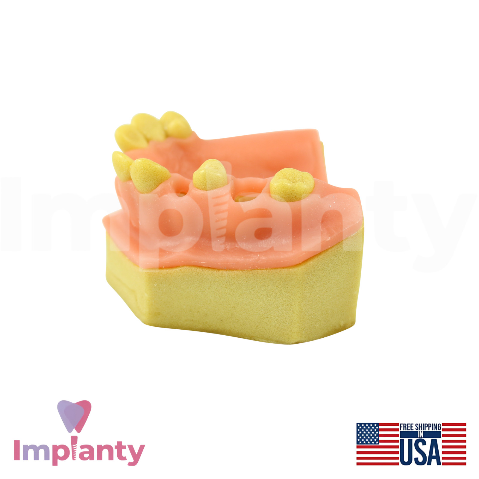 Upper Jaw Model With Missing Teeth Dental Teaching and Dentistry Practice Aid