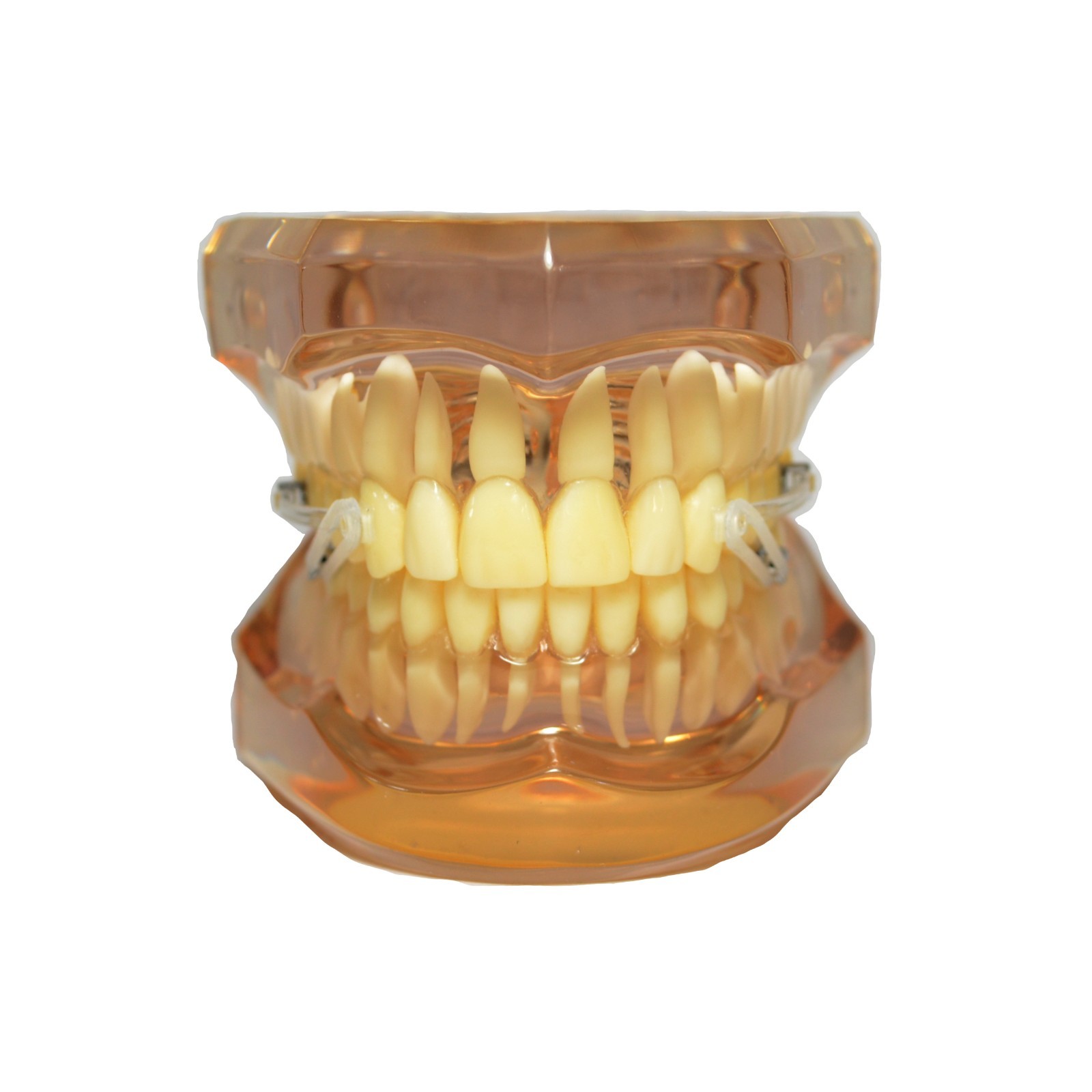 J&J Ortho™ BiteForce NC4 Orthodontic Clear Distalizing Bar Appliance (2/pair)