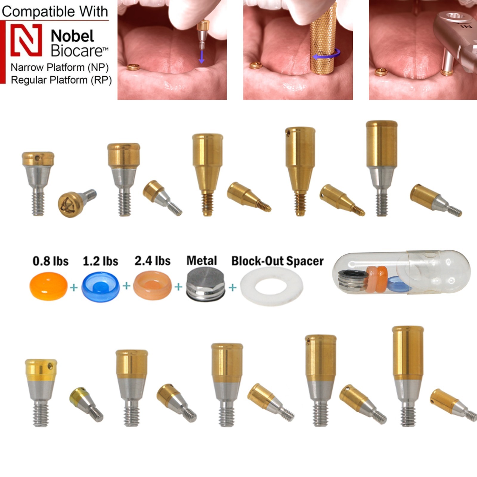 Dental Fit Zest Locator Abutment Legacy Anchor Overdenture Hiossen Zimmer Nobel
