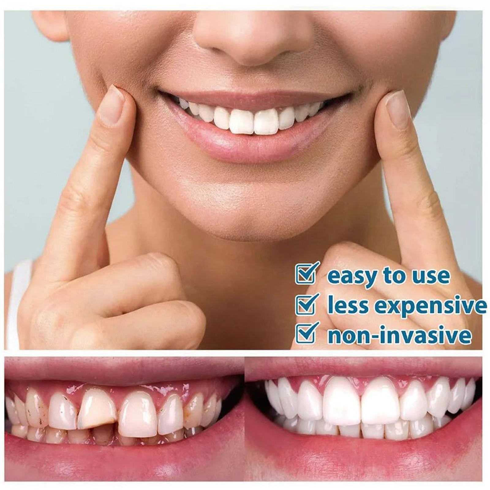Supplement Syringe Tooth Filler Tooth Repair Resin Teeth Putty Bonding Glue