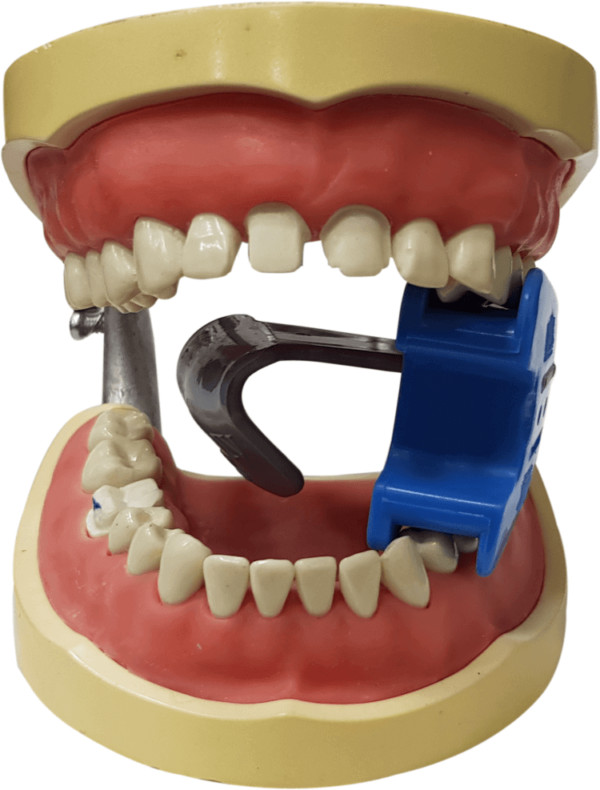 MiK Isolator Kit – 1 Mouth Prop & 8 Tongue Deflectors