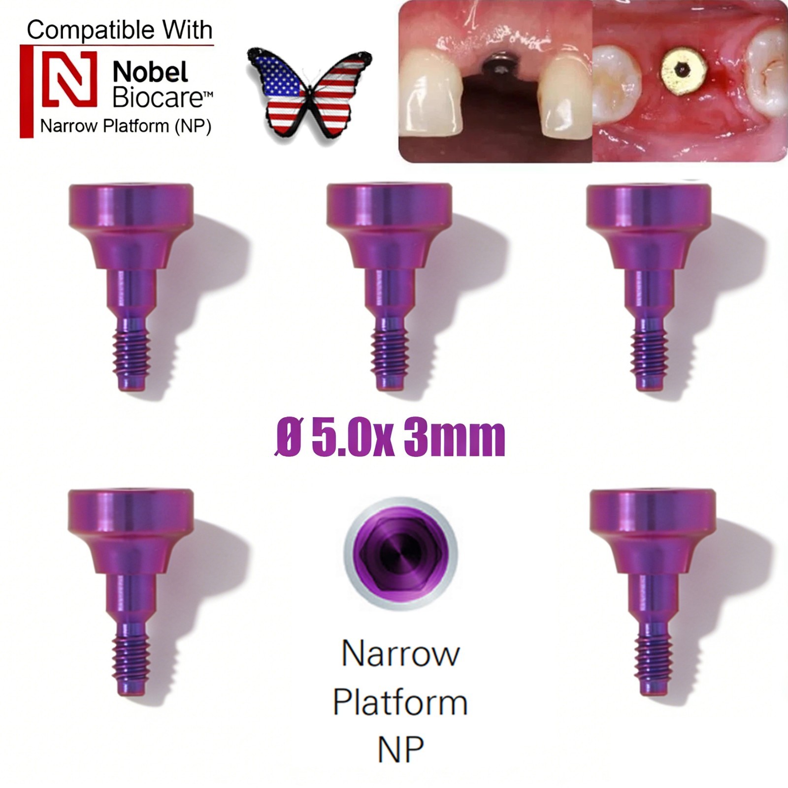 US 5Pc Dental Healing Abutment NP/RP Fit Nobel Biocare Internal Conical Titanium