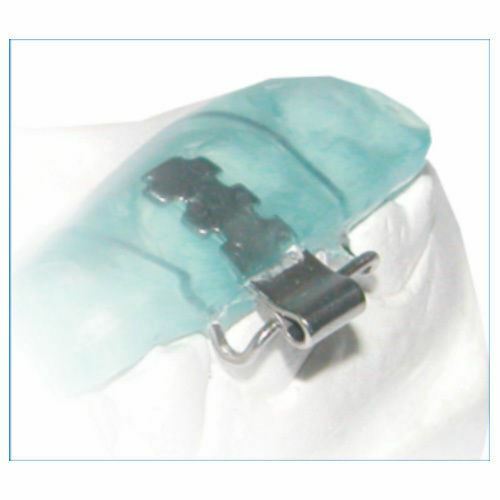 Morelli Dental Orthodontic Tube Activator With Bar For Treatment Class II