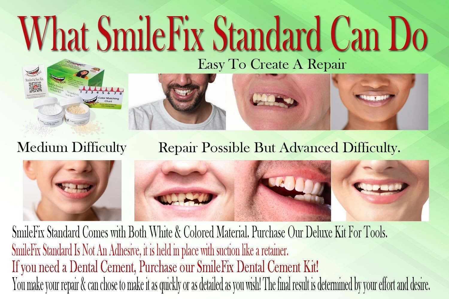 Dental Repair Kit Color Matching Compound Fix Gaps Broken Teeth Home Use