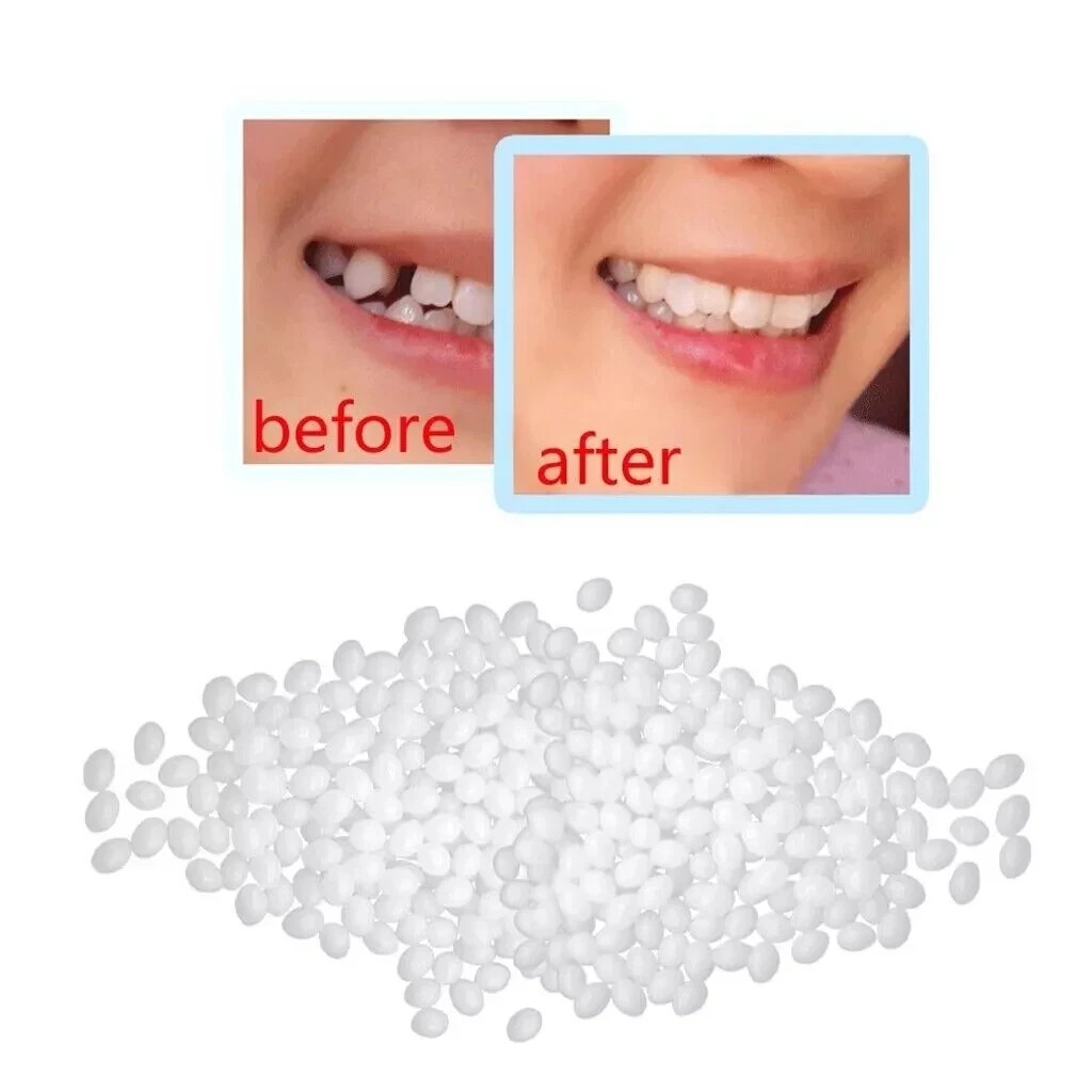 Dental Moldable Thermal Temporary Filling Tooth Material False Repair Replacemen
