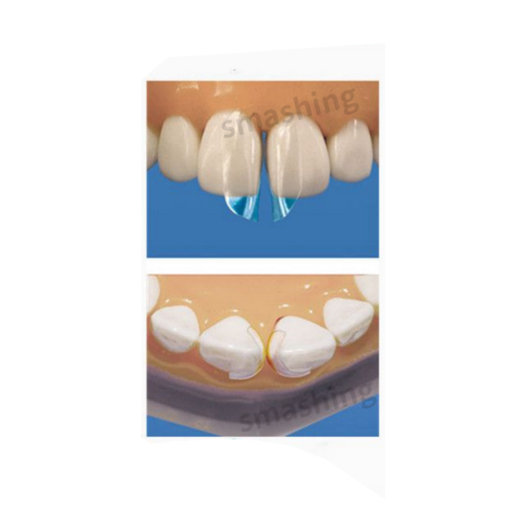 Dental Clear Matrix Anterior Matrices Bow BT Fits Bioclear L/M/S Matrice TOR VM
