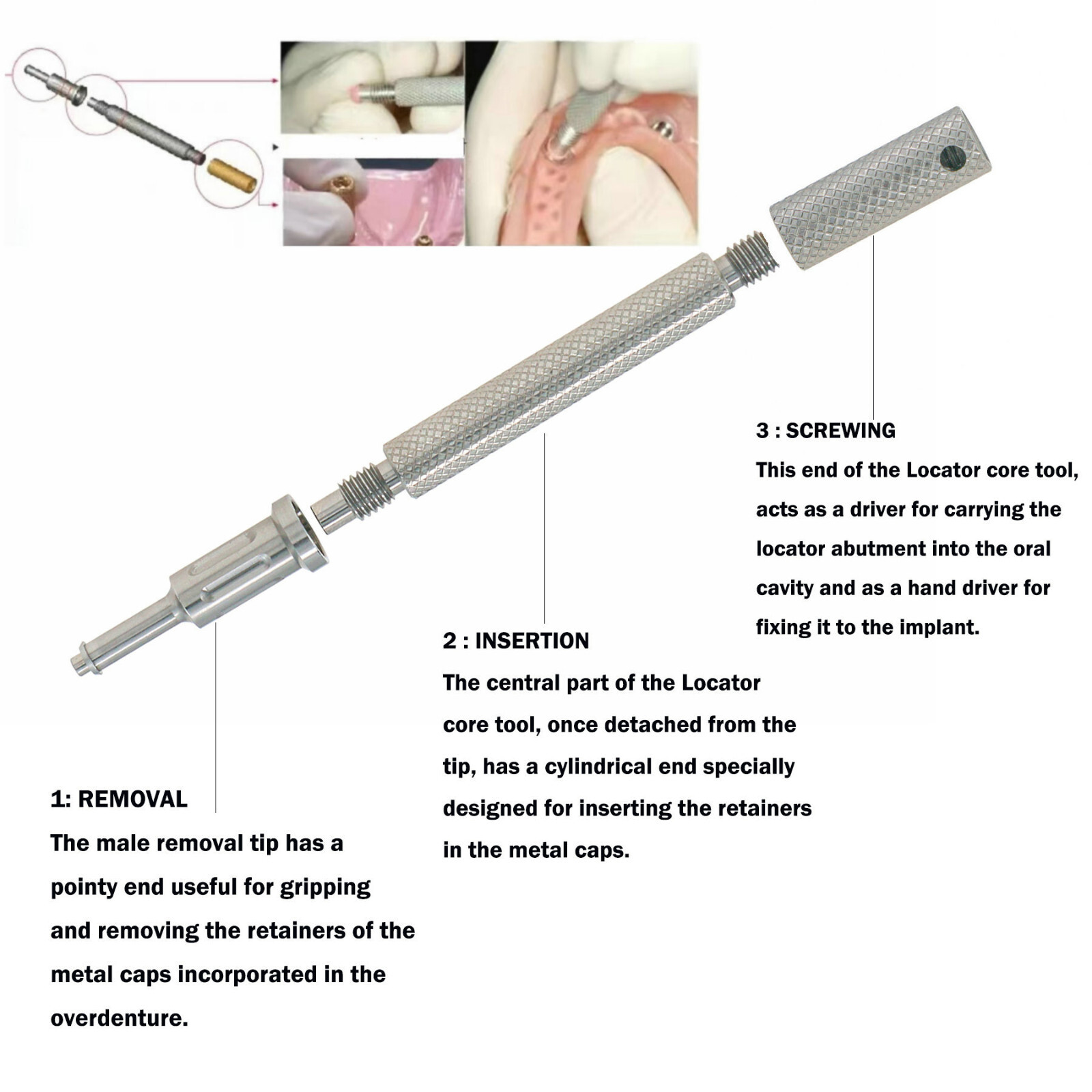 US Universal Dental Locator Retention Caps Insertion Extraction Remove Core Tool