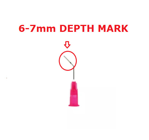 GINGICaine Round Ended Delivery Pink Special Tips with 6-7 mm Depth Mark 20/Box