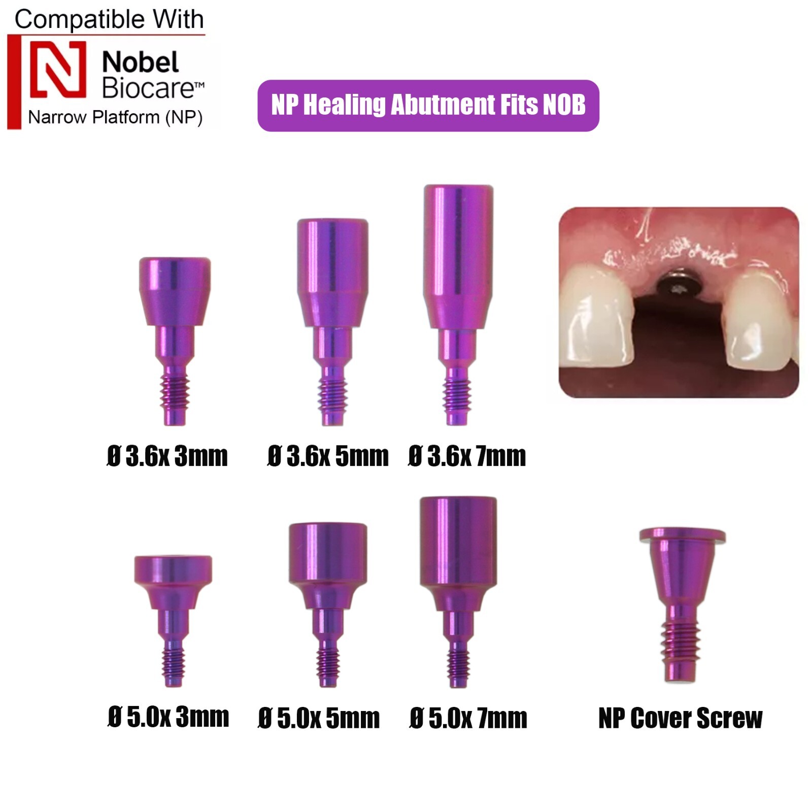 Dental Healing Abutment Cover Screw for ITI, Hiossen, Nobel, NC/RC, Regular/Mini