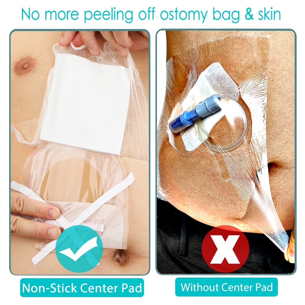 EaseCare Waterproof Ostomy Bag One Size, Cover(10″x12″, Pack of 7)