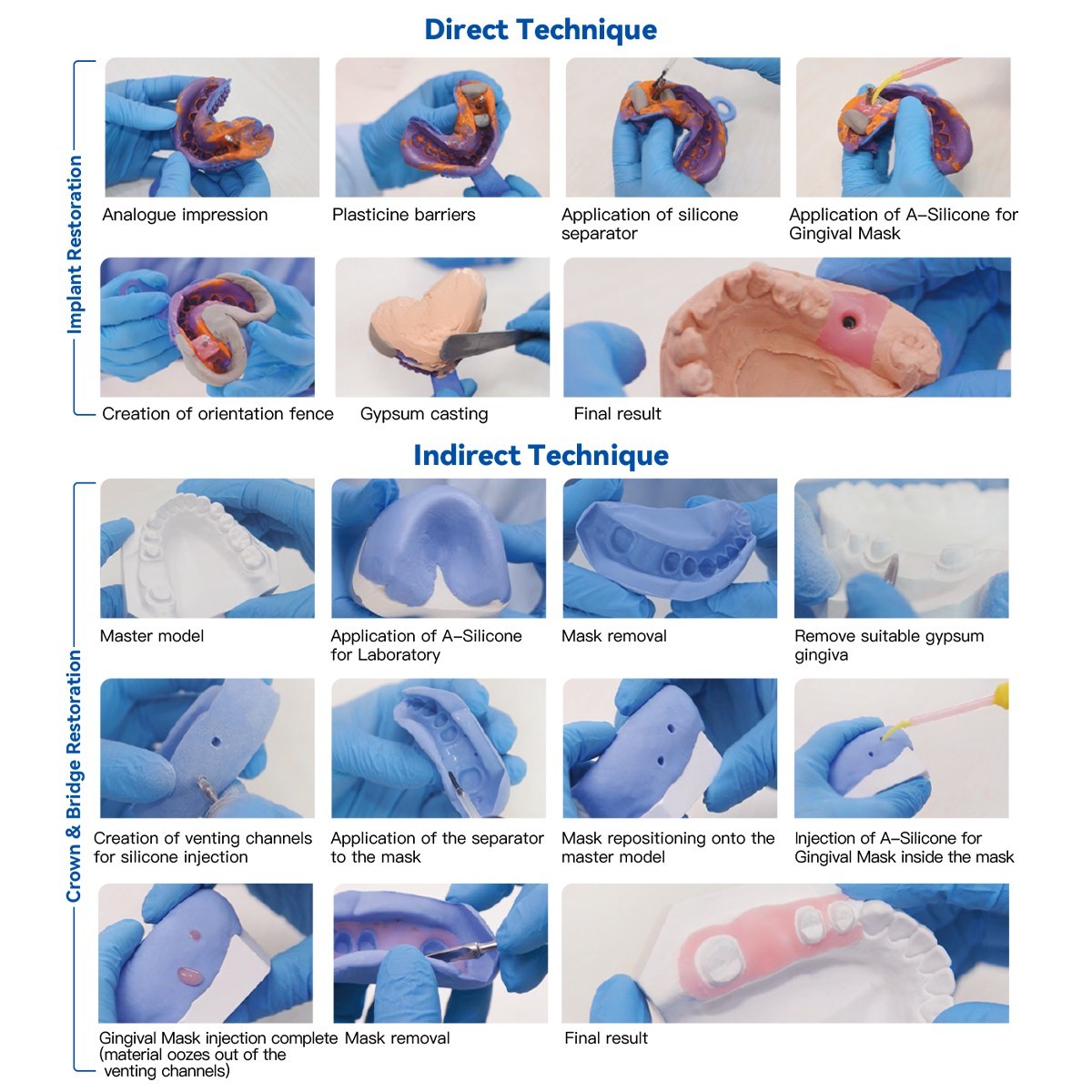 AZDENT Automix Flexible A-Silicone for Gingival Masks Duplication Silicone USA