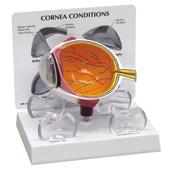 Eye Cataract Cornea Eye Set of 3 GPI Anatomy Models #4021 Make Offer! SEE VIDEO
