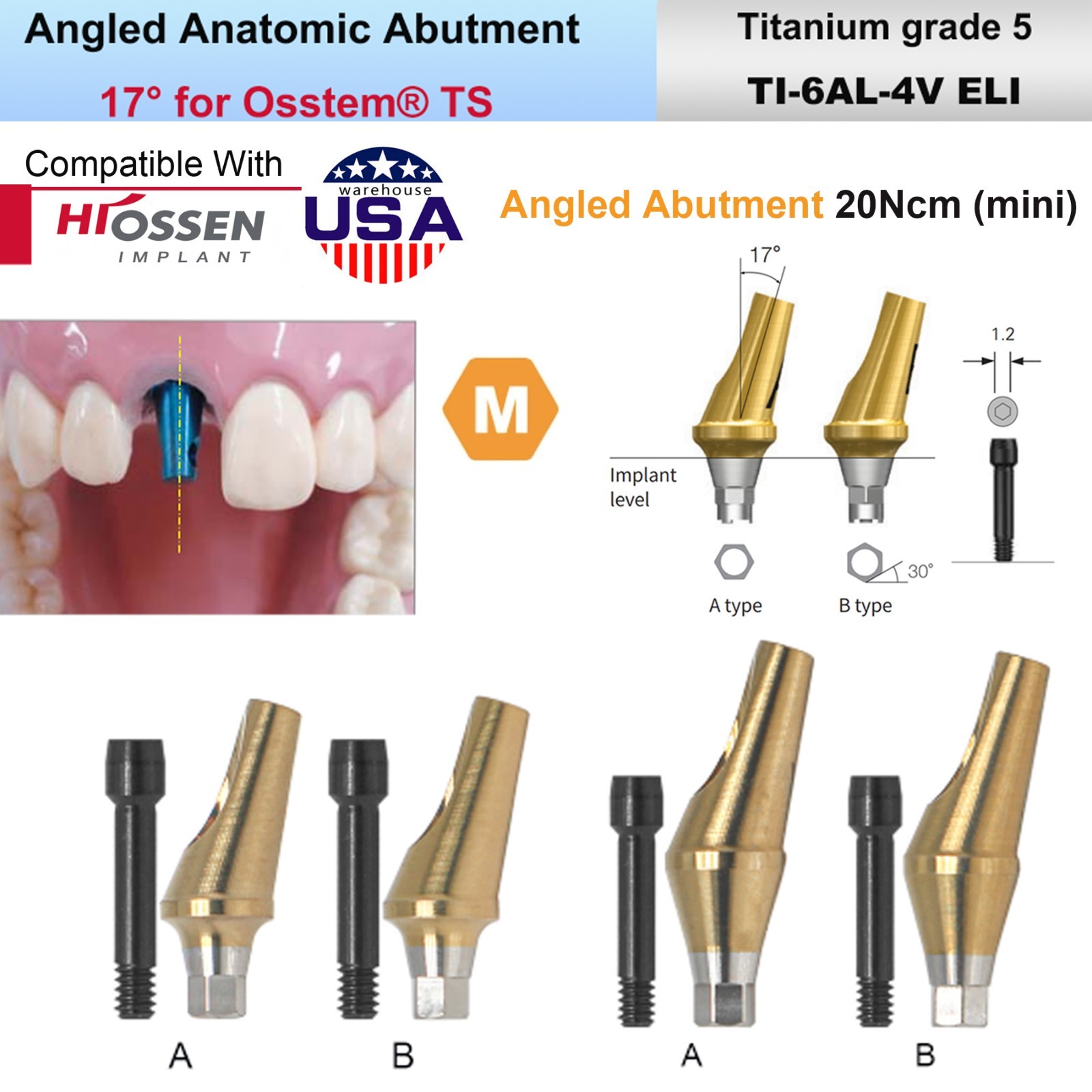 US Fit Hiossen ET / Osstem TS Dental Titanium Abutments & Restorative Components