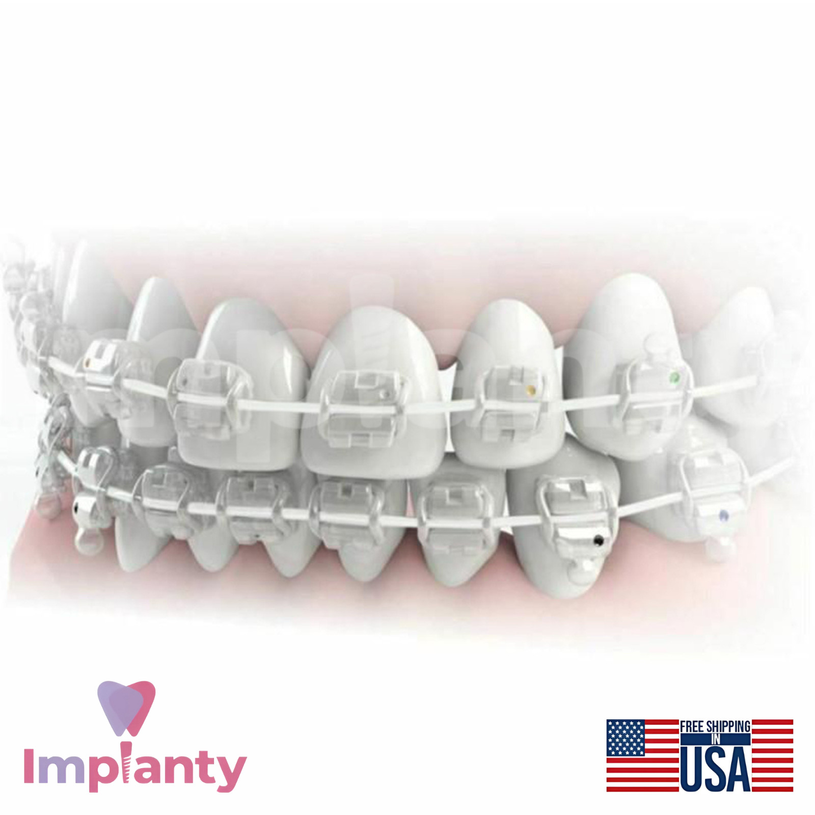 Morelli NiTi Superelastic Aesthetic Rectangular Dental Archwire Upper Jaw 5pcs