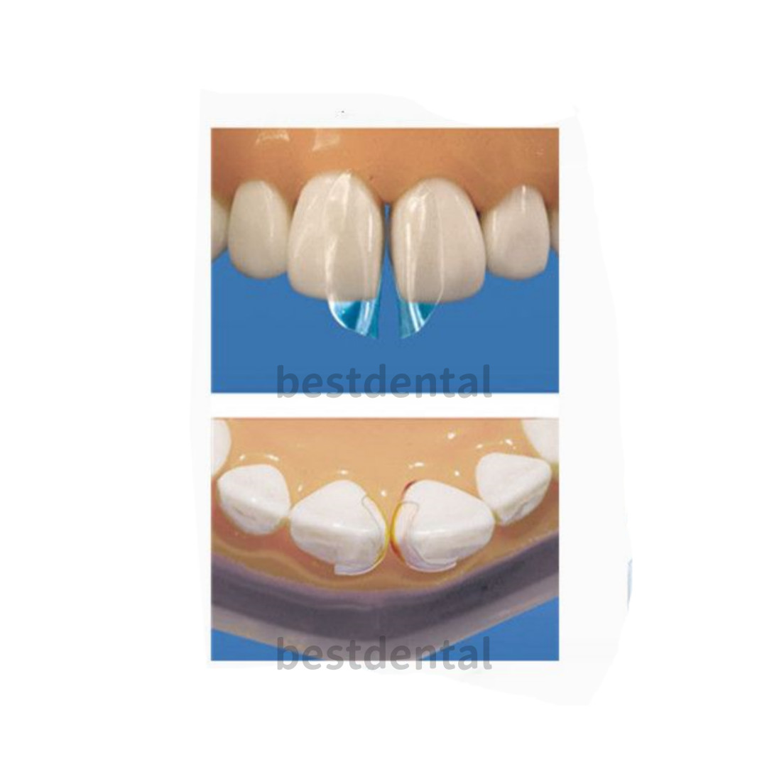 Dental Clear Matrix Transparent Anterior Matrices Bow Fit Bioclear L/M/S TOR VM