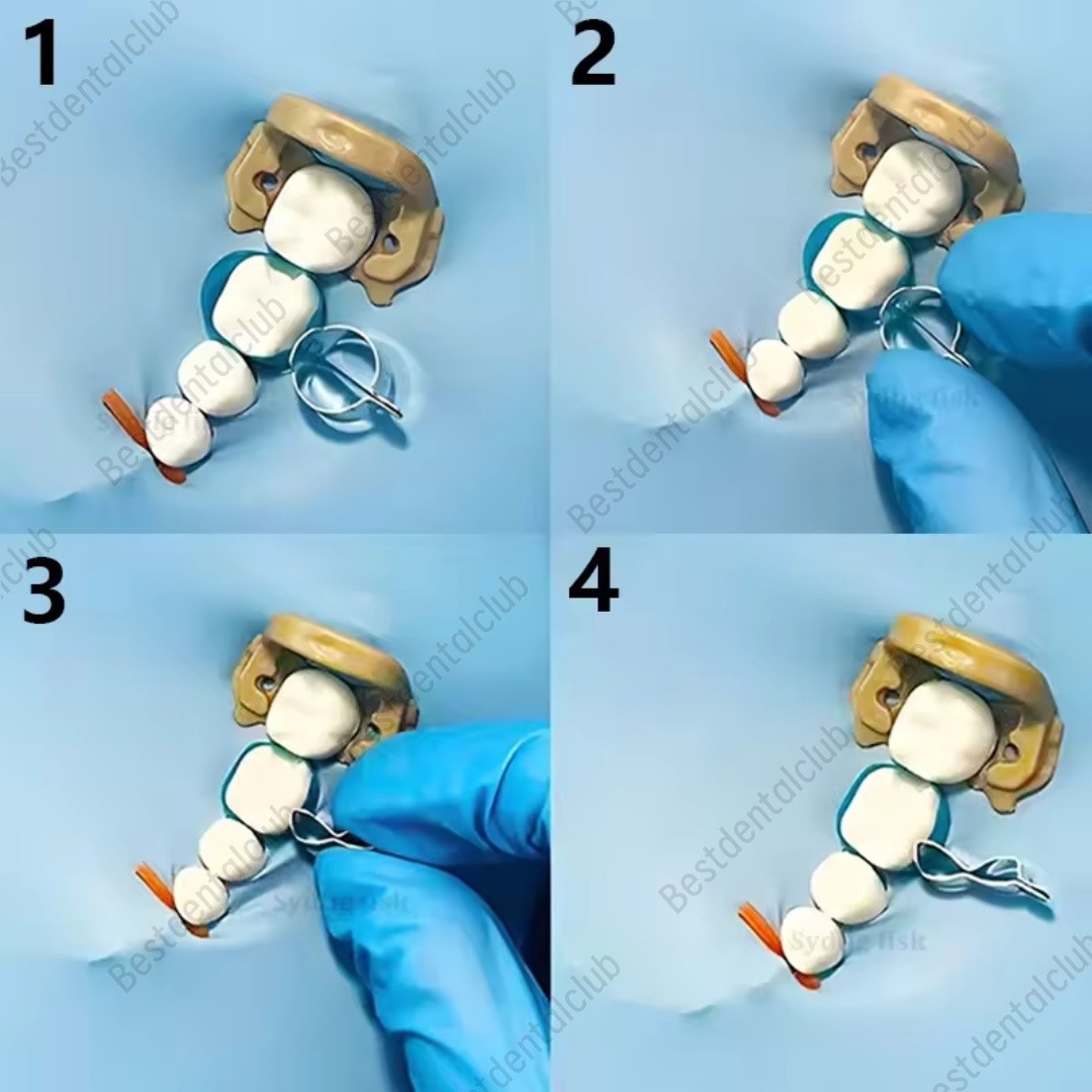Dental Blue Posterior Matrices Ring Molar Premoar Matrice Strips M12 1.0 USA
