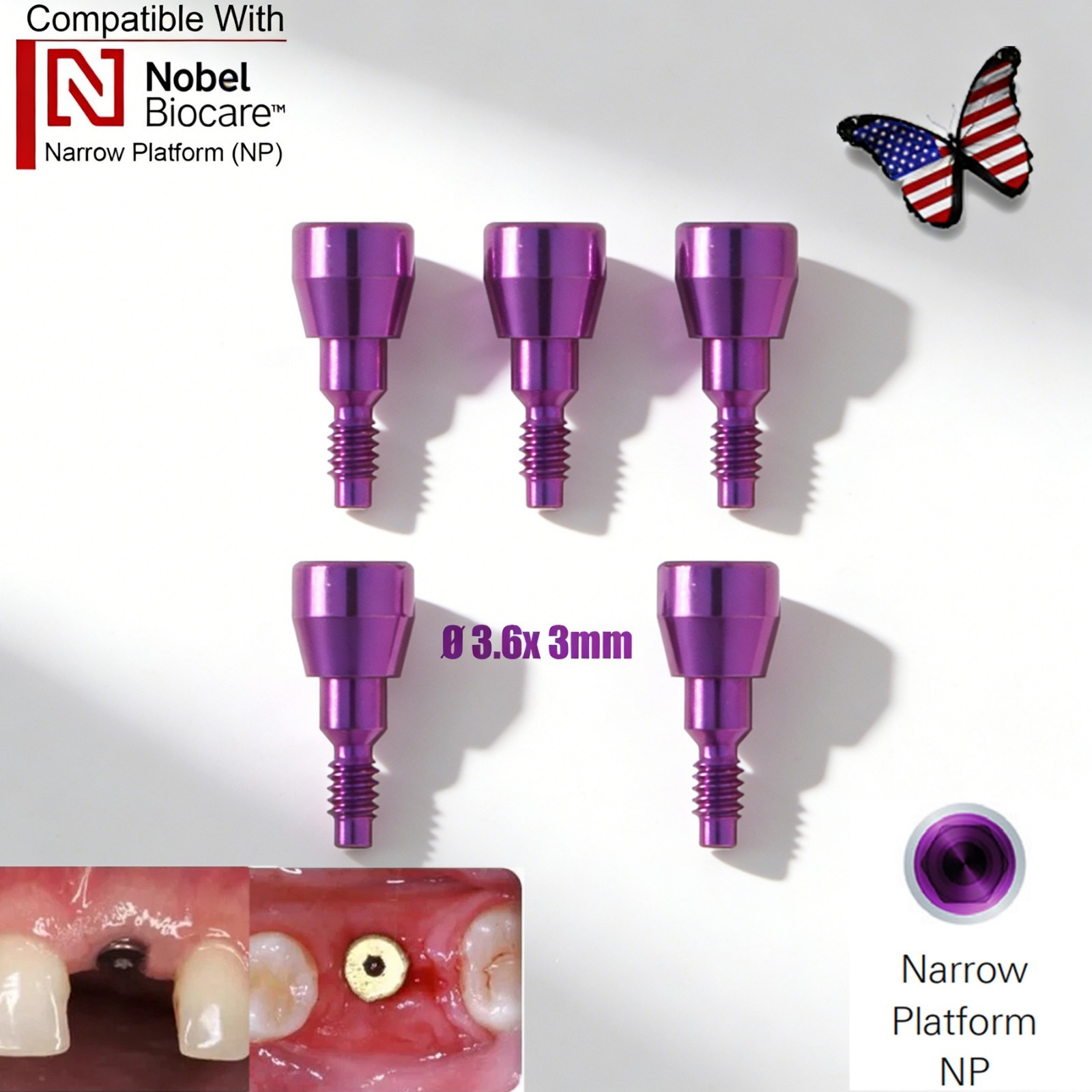 US 5Pc Dental Healing Abutment NP/RP Fit Nobel Biocare Internal Conical Titanium