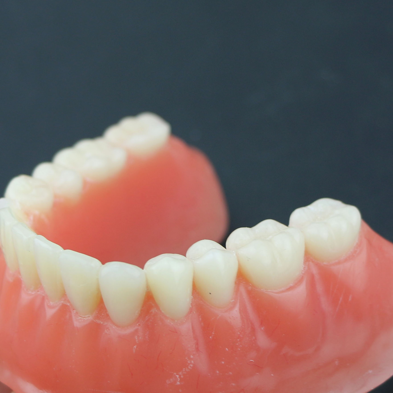 Dental Teeth Implant Model Inferior Overdenture 4 Implants Denture Demo Training