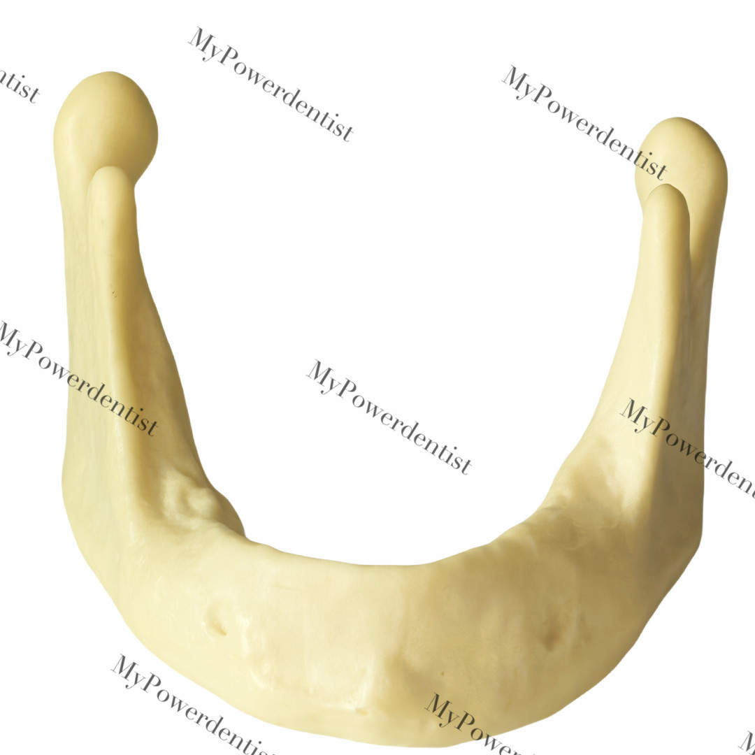 Dental Resin Alveolar Jaw Bone Replica Study Model Embed GBR Practice Blocks