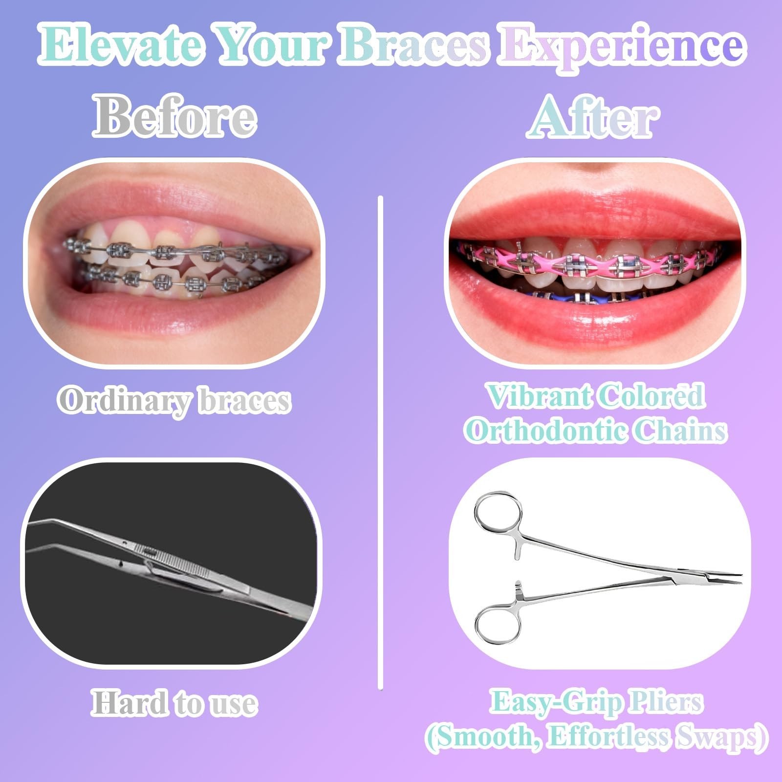 Color Changing Dental Braces Kit with Orthodontic Plier & 5 Power Chains – DIY A