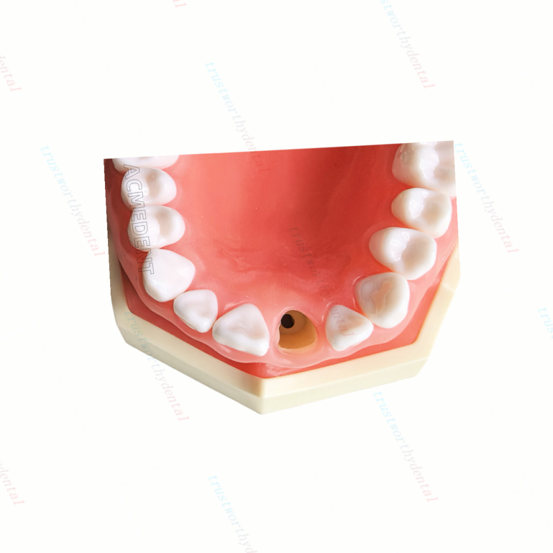 Dental Typodont Model with Removable Teeth M8011 DP 32 Demonstration Teach Study