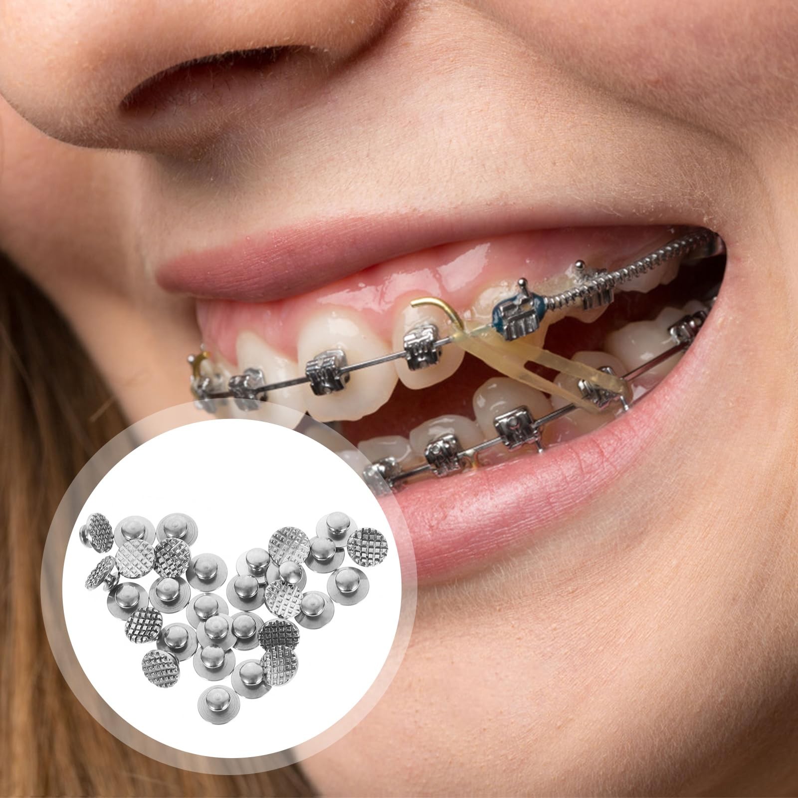 Healifty 30pcs Dental Orthodontic Lingual Buttons Bondable Round Base