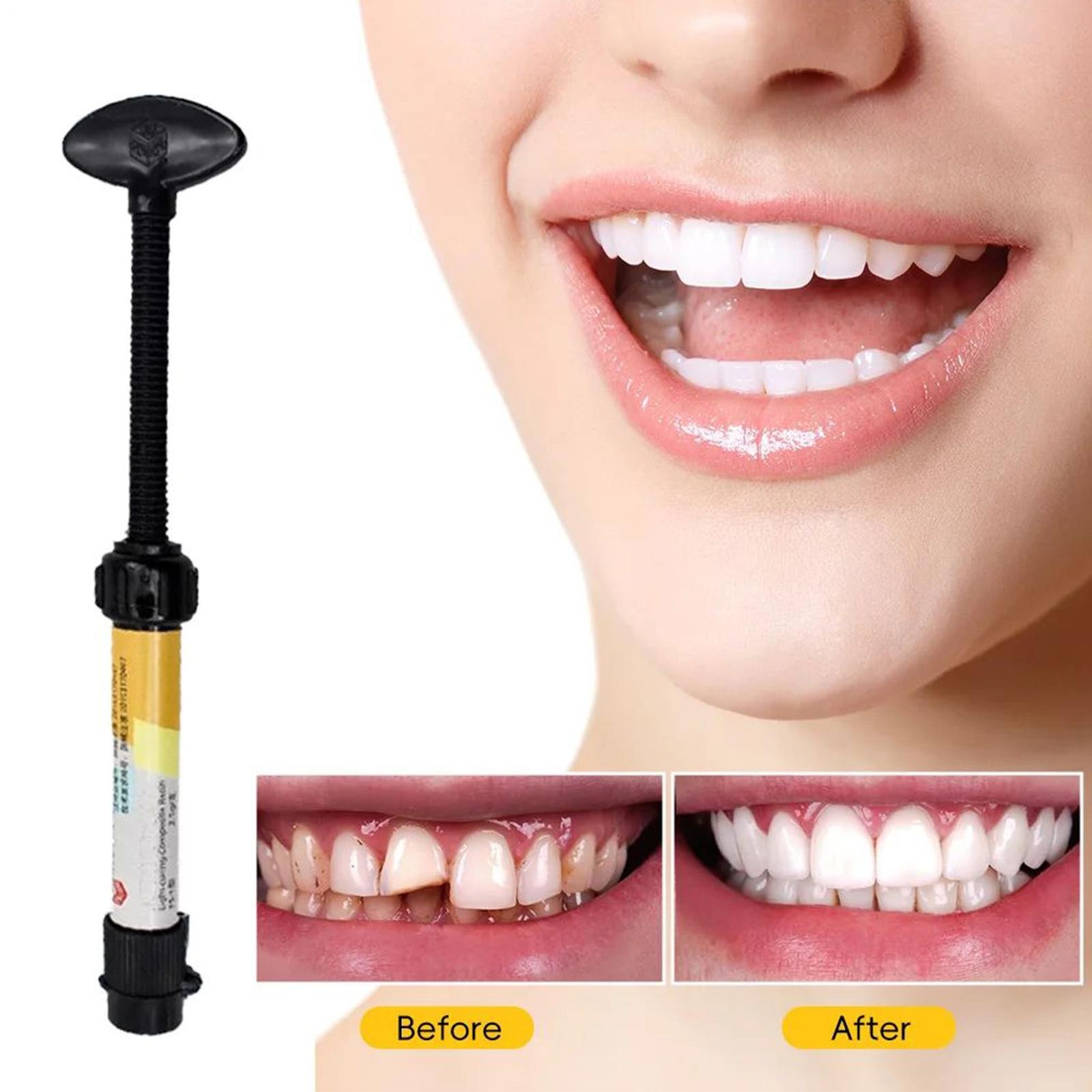 Supplement Syringe Tooth Filler Tooth Repair Resin Teeth Putty Bonding Glue