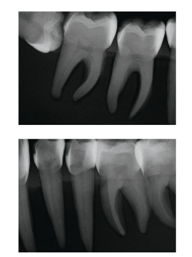 Dental Teeth X-Ray MANIKIN Practice Exam Adult Simulator Training Phantom