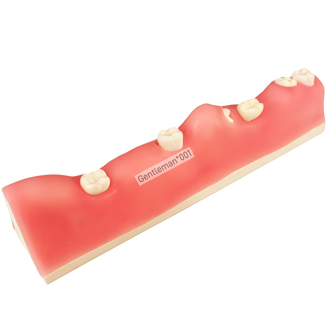 Dental Impacted Tooth Model Extraction Unerupted Tooth Practice Trainin M8038
