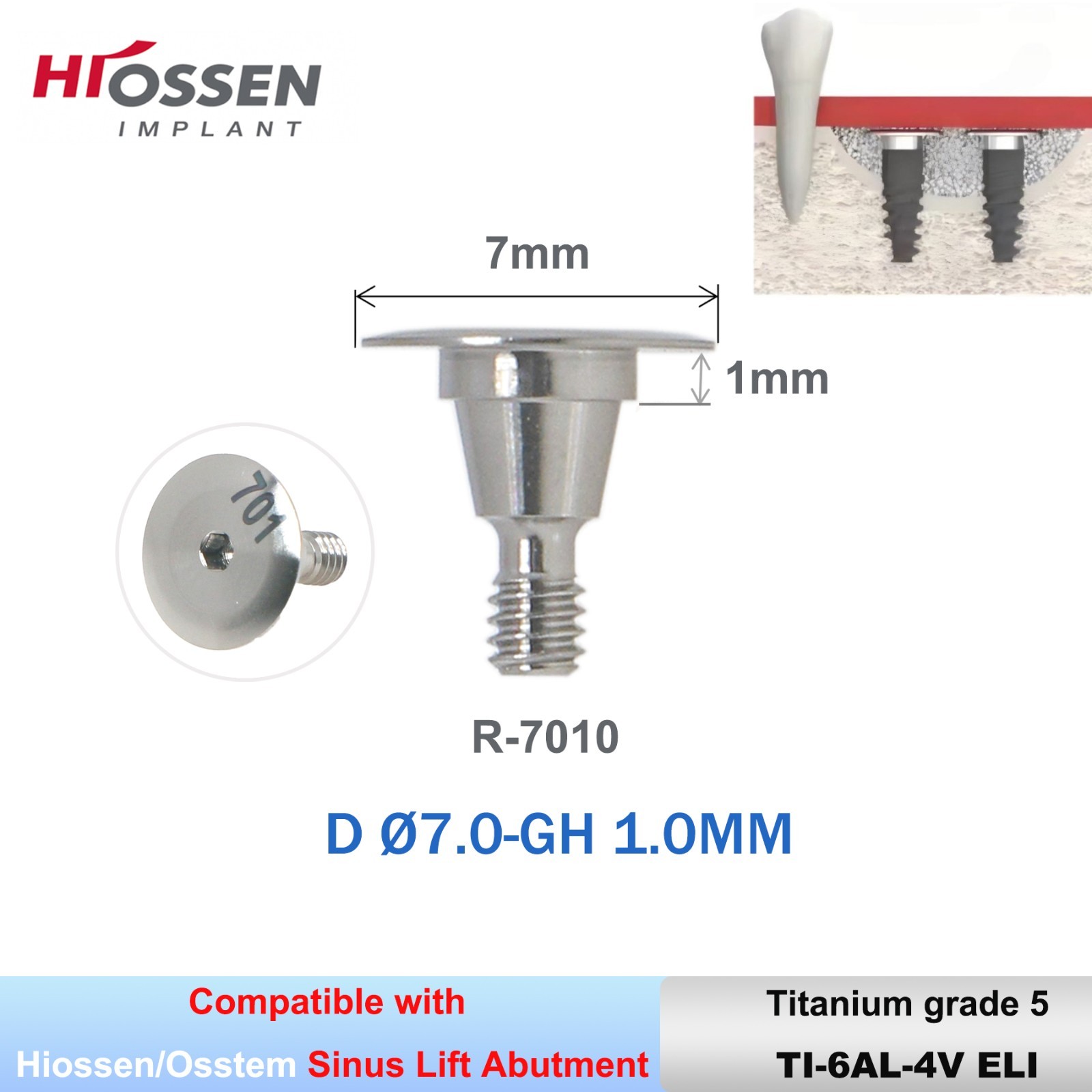 Hiossen R Sinus Lift Abutments Ø6-9mm Titanium 4-Leaf Design Fit Osstem/DIO UF R