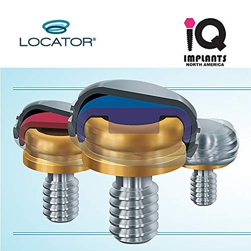 Replacement Male Retention Inserts Caps – Extended Range, Low Retention, Red (4-