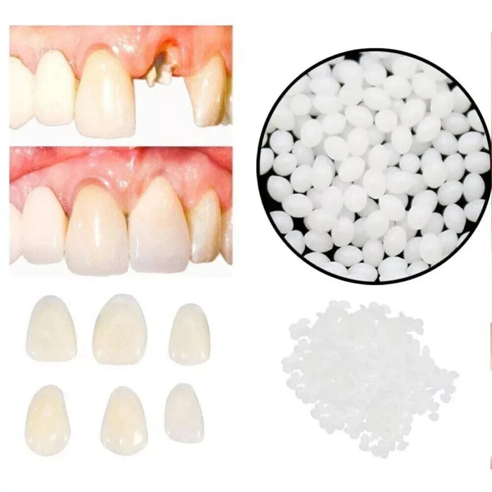 Dental Moldable Thermal Temporary Filling Tooth Material False Repair Replacemen