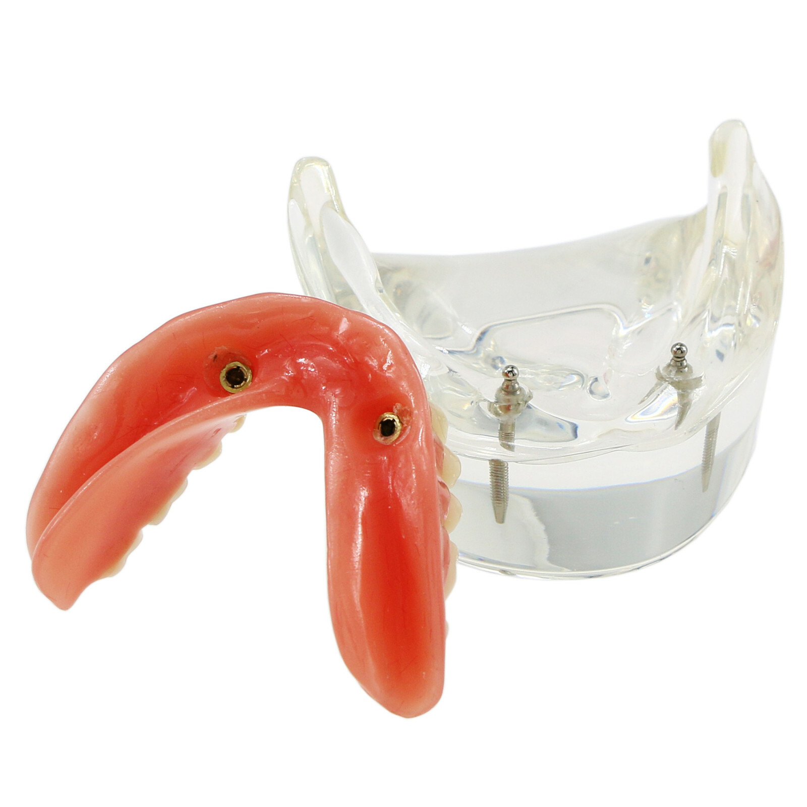 Dental Typodont Teeth Model Overdenture Lower Inferior 2 Implants Demo M-6002 US